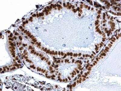 Immunohistochemistry-Paraffin: HIST1H3A [ac Lys18] Antibody [NBP2-43535]